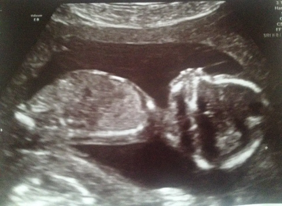 Nutritionist Confessions: Some time out...