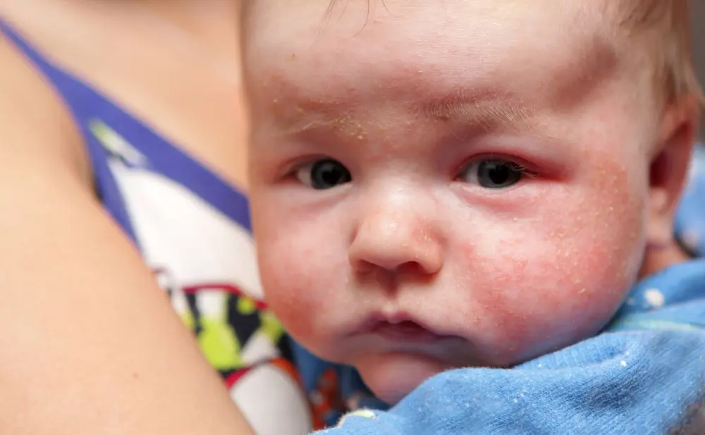 Probiotics for Babies and Young Children